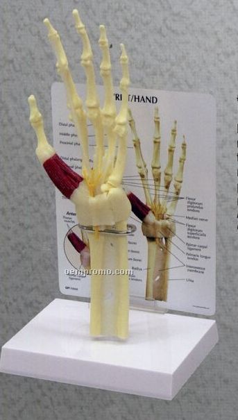 Anatomical Wrist/ Hand Model With Carpal Tunnel Syndrome