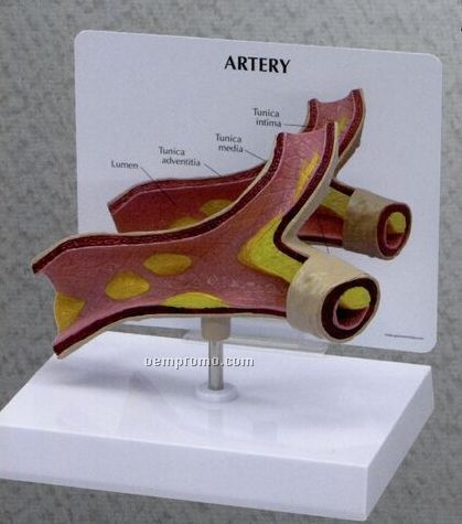 Anatomical Artery Model W/ Build Up Of Cholesterol Deposits