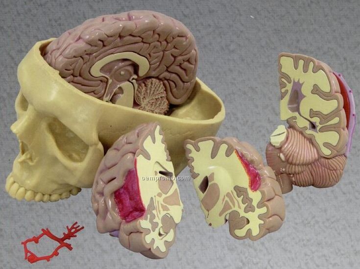 Anatomical Brain Model (Normal Half/ Pathology Half)
