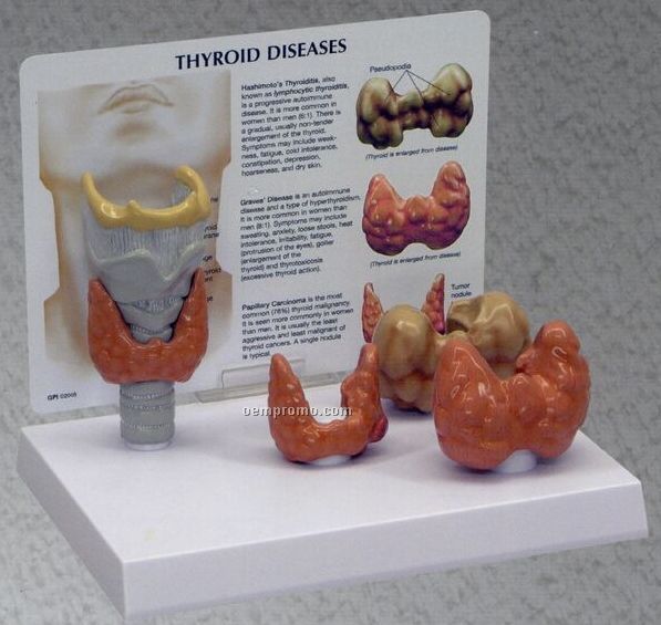 Thyroid Model - Set Of 4 (Normal + 3 Conditions)