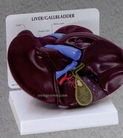 Anatomical Liver/ Gallbladder Model With Gallstones