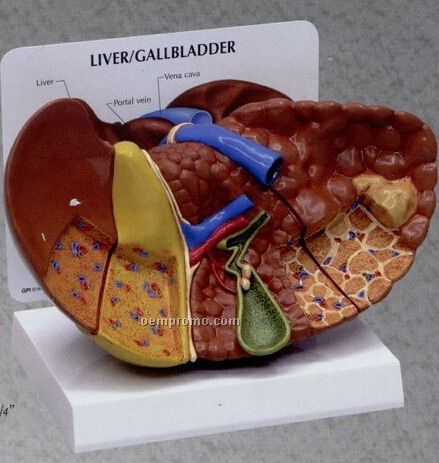 Anatomical Liver Model W/ Pathologies (Normal + 3 Conditions)