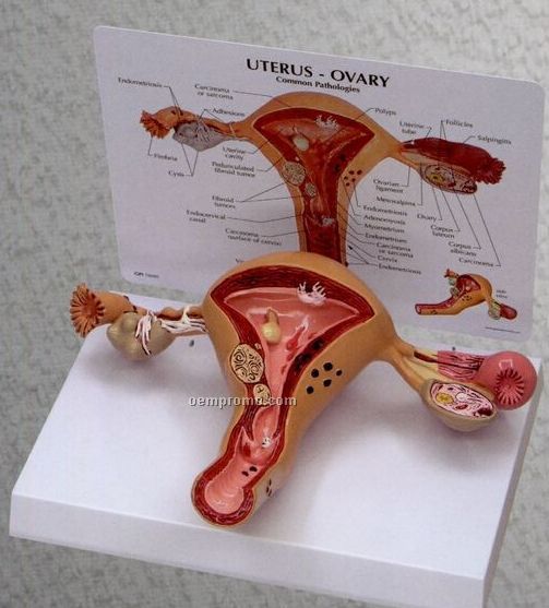 Anatomical Uterus/ Ovary Model