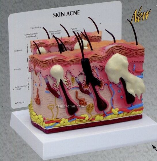 Anatomical Skin 2 Sided Cross Section Model (Normal/ Acne)